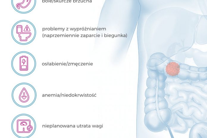 Immunoterapia Już Dostępna Dla Chorych Z Rakiem Jelita Grubego Isb Zdrowie 9056